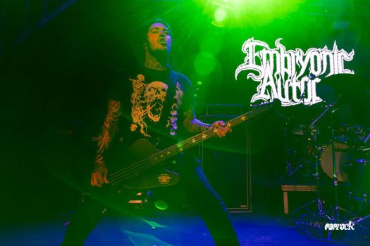 Embryonic-Autopsy-05